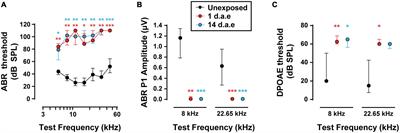 Noise Exposure Potentiates Exocytosis From Cochlear Inner Hair Cells